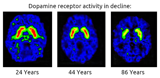 Brain scans