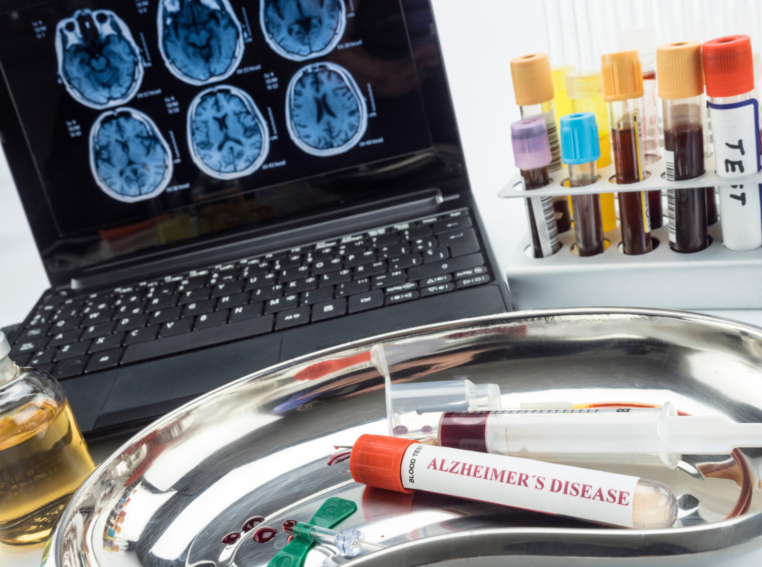Computer with brain images and a blood sample